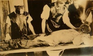 Soviet POW Dissected Alive