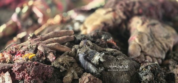 Burnt Body-Parts of Israeli Victims!