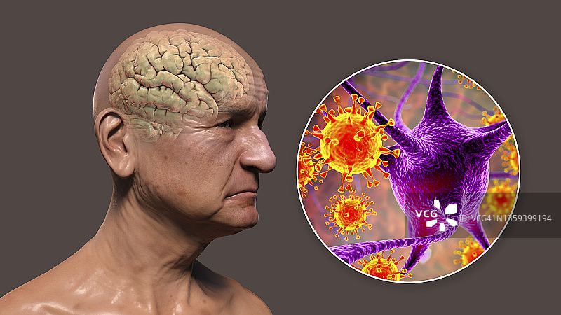 Has Covid-19 Increased "Greed" Throughout Society?