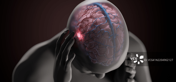 Has Covid-19 Altered the physiology of the Brain?