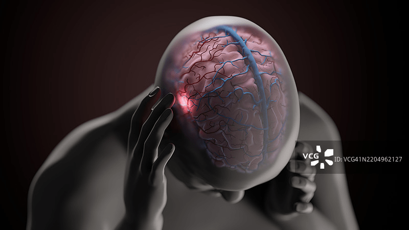 Has Covid-19 Altered the physiology of the Brain?