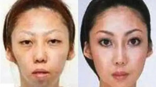 Woman at Centre of Plastic Surgery Scandel!