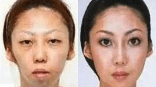 Woman at Centre of Plastic Surgery Scandel!
