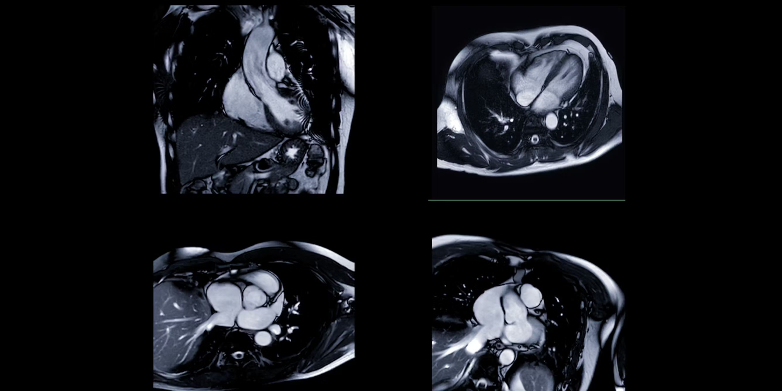 AI can guess racial categories from heart scans – what it means and why it matters