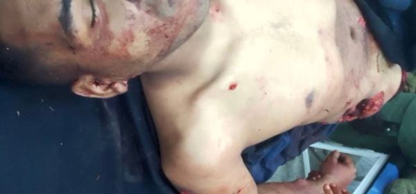 A Hero Cuban Soldier - Killed by the Forces of Capitalism!