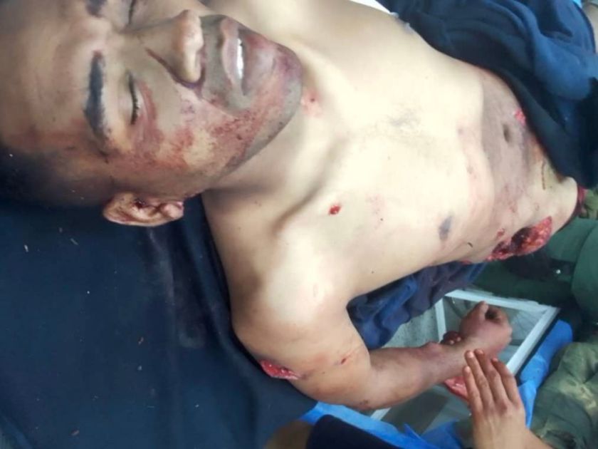 A Hero Cuban Soldier - Killed by the Forces of Capitalism!