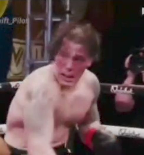 Paul Miller Suffers Intense Tissue Damage Due to Steroid-Taking!