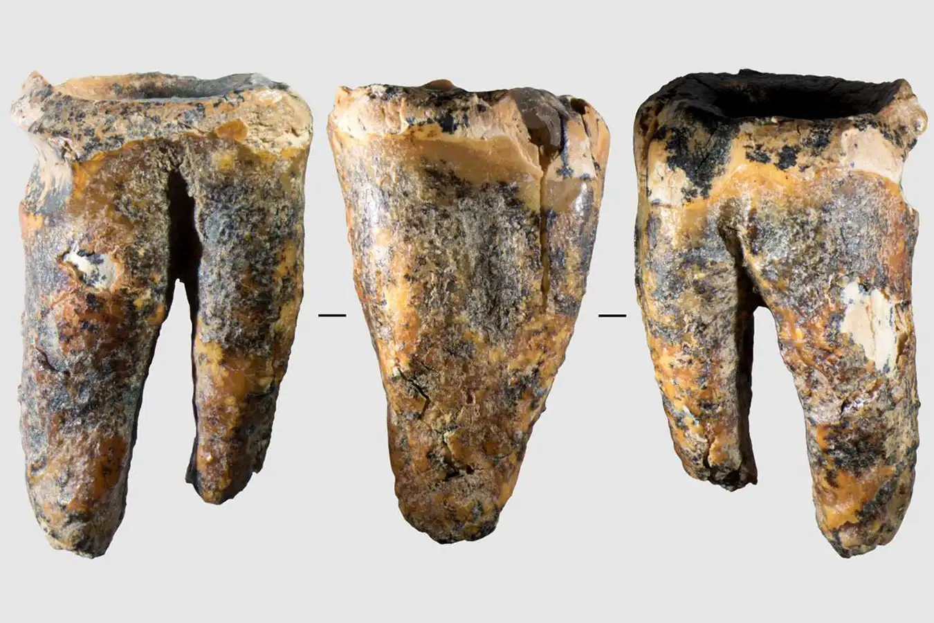 Three views of the Neanderthal tooth with evidence of dental treatment

Hexian Culture, Tourism and Sports Bureau, Ma’anshan