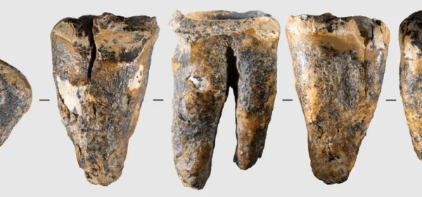 The Neanderthal dentist who worked on the 59,000-year-old molar had some experience treating cavities.