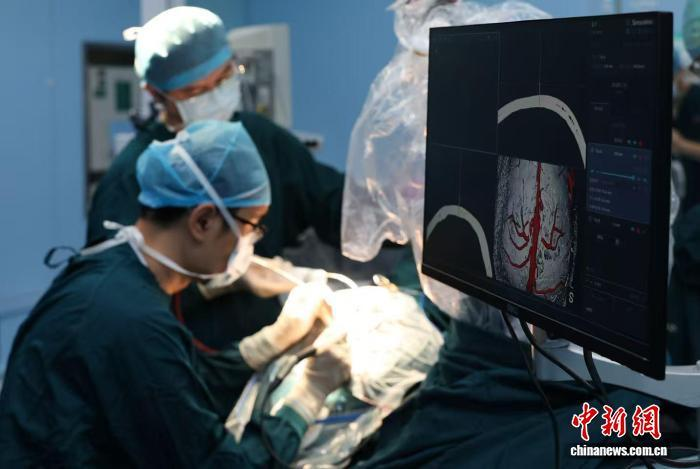 Doctors from Tongji Medical College perform fully invasive brain-computer interface surgery on a patient. (Photo provided to China News Service)