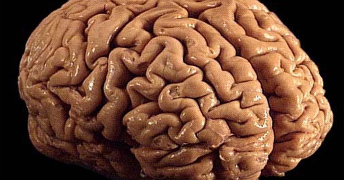 Human Brain Folds PRC 2026