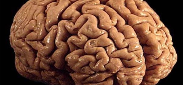 Human Brain Folds PRC 2026