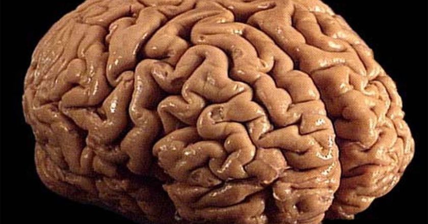 Human Brain Folds PRC 2026